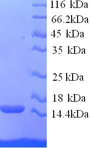 Human RNF7 Protein (Recombinant His)