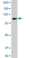 Monoclonal Mouse anti-Human DYRK / DYRK1A Antibody (clone 7D10, WB)