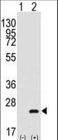 BARX1 Antibody (aa119-148)