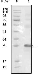 IHC-plus™ Monoclonal Mouse anti-Human EPHB3 / EPH Receptor B3 Antibody (clone 4A122D1, IHC, WB)