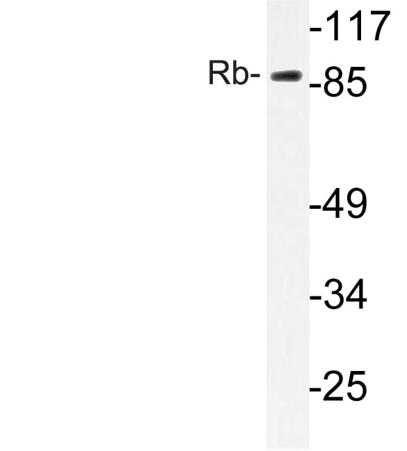 RB1 / Retinoblastoma / RB Antibody (Ser807)
