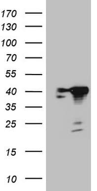 Monoclonal Mouse anti-Human CIAPIN1 / Anamorsin Antibody (clone OTI1C11, aa97-312, WB)