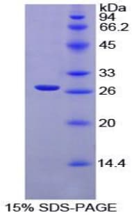 Rat XRCC6 / Ku70 Protein (Recombinant His-T7)