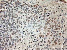 Monoclonal Mouse anti-Human GAD1 / GAD67 Antibody (clone OTI3G9, IHC, WB)