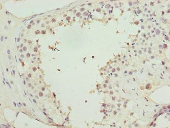 RBBP4 / RBAP48 Antibody