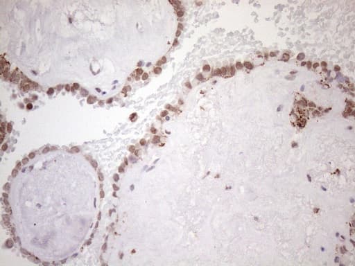 SRSF9 / SFRS9 Antibody (clone OTI5A12)