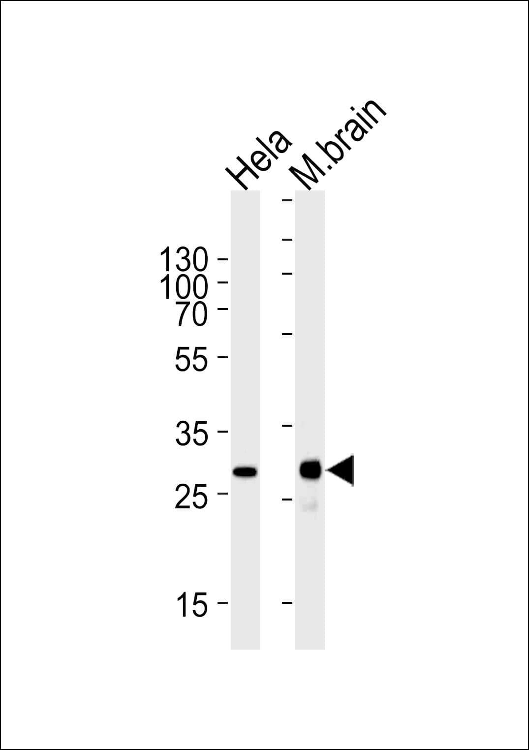 CDK5 Antibody (aa160-286, clone 1321CT281.130.129)