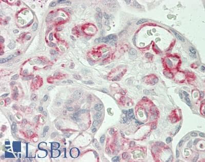 IHC-plus™ SLC28A2 Antibody (Internal)