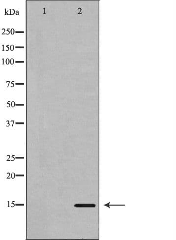 Polyclonal Rabbit anti-Human KISS1 / Kisspeptin / Metastin Antibody (IHC, IF, WB)
