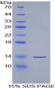 Human GPT / Alanine Transaminase Protein (Recombinant His)