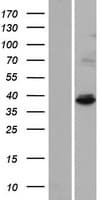 IBA57 / C1orf69 Protein (Over-Expression Lysate Myc-DDK (Flag))