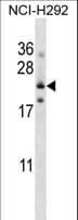 IHC-plus™ Polyclonal Rabbit anti-Human FOLR3 Antibody (aa24-53, IHC, WB)