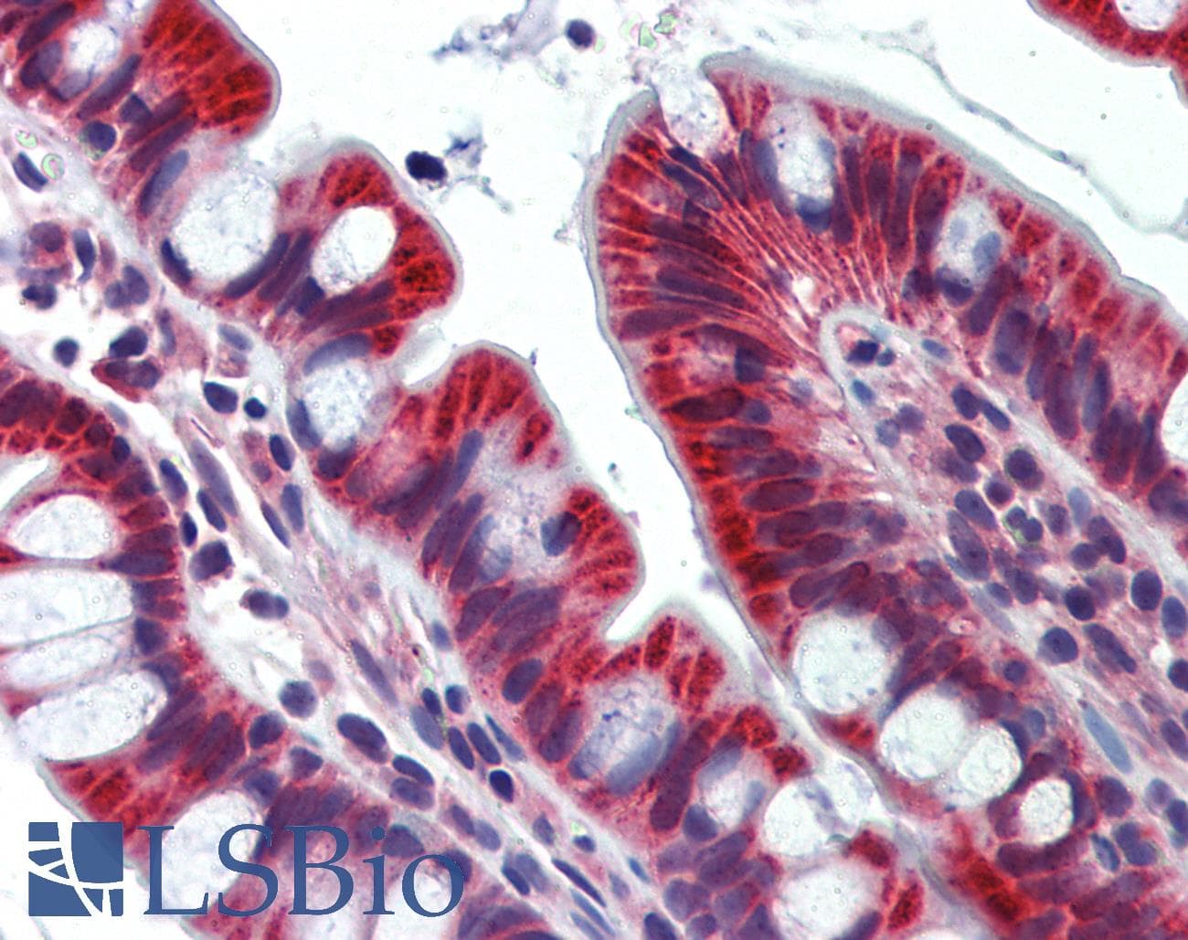 IHC-plus™ Polyclonal Rabbit anti-Human JPH4 Antibody (IHC, WB)