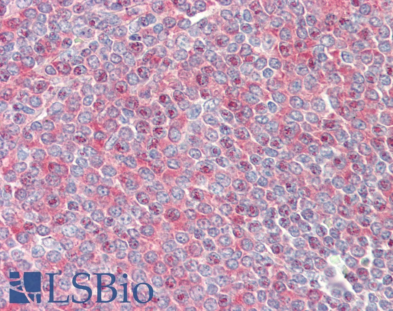 IHC-plus™ Polyclonal Goat anti-Human PRKCB / PKC-Beta Antibody (aa631-642, IHC, WB)