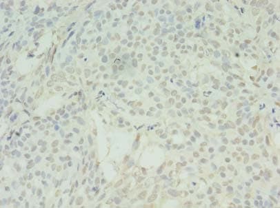 SDHC Antibody