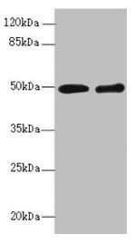 Polyclonal Rabbit anti-Human ZBTB25 Antibody (IHC, WB)
