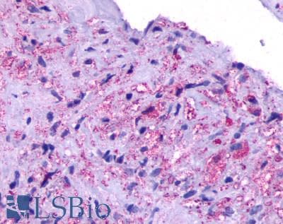 PathPlus™ Polyclonal Rabbit anti-Human OPN5 / Neuropsin Antibody (Transmembrane Domain, IHC)