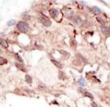 SUV39H2 Antibody (aa360-390)
