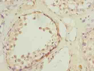 HTR1E / 5-HT1E Receptor Antibody