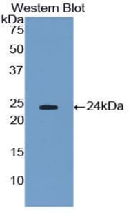 cPLA2 Antibody (aa563-749)