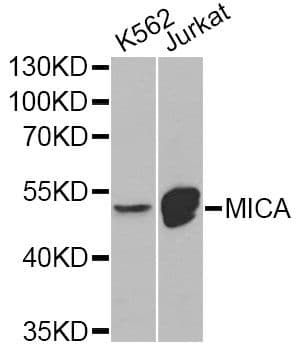 MICA Antibody