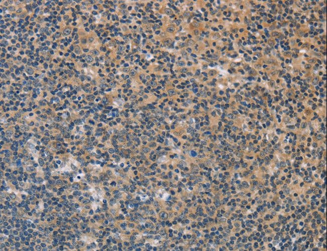 FXYD1 / Phospholemman Antibody