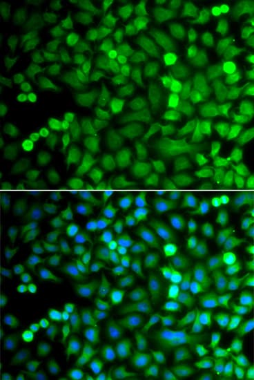 OSGEP Antibody