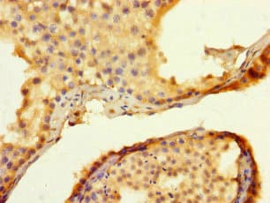 TRIM74 Antibody