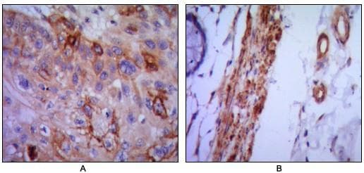 VCAM1 / CD106 Antibody (clone 6G9)