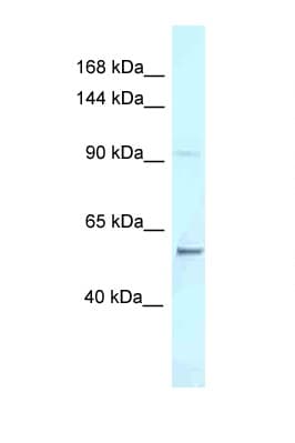 Polyclonal Rabbit anti-Mouse LAF4 / AFF3 Antibody (C-Terminus, WB)