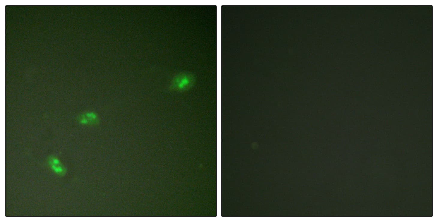 Polyclonal Rabbit anti-Human NPM1 / NPM / Nucleophosmin Antibody (phospho-Thr199, IHC, IF, WB)