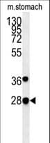 PREPL Antibody (aa624-652)