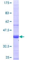 Human RAB28 Protein (Recombinant GST)