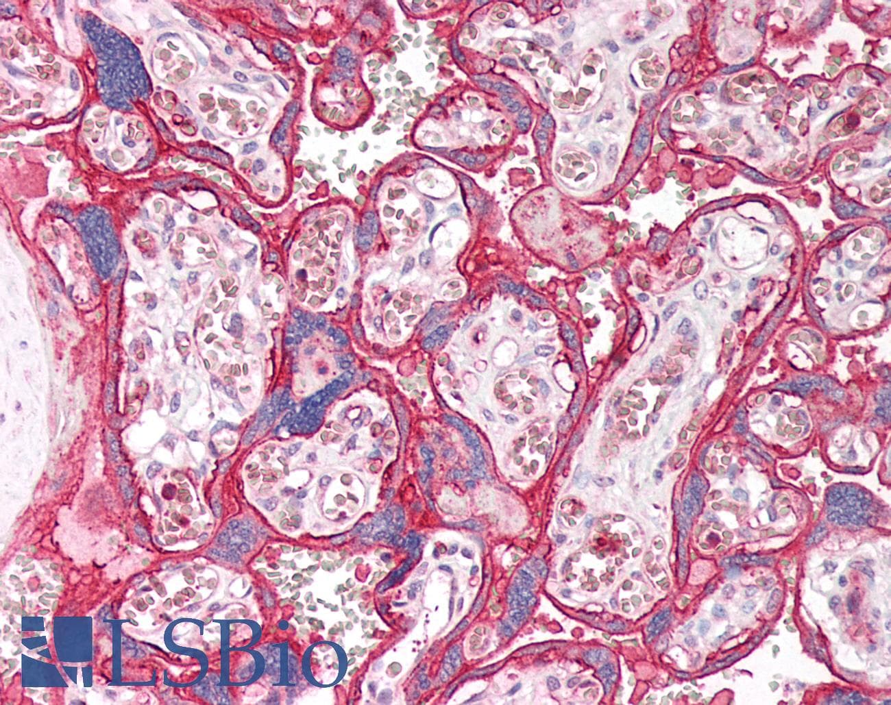 SLC2A3 / GLUT3 Antibody