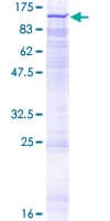 Human NADSYN1 / NAD Synthetase Protein (Recombinant GST)