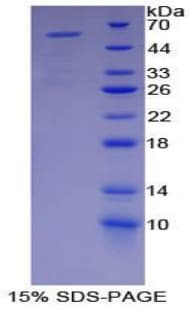 Mouse MYH2 Protein (Recombinant His-GST)