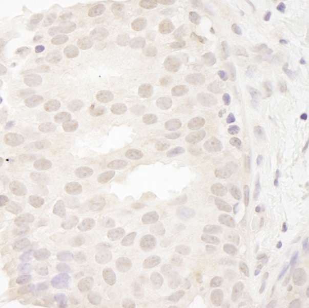 CASC5 Antibody (aa300-350)