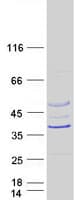 Human RSPH14 / RTDR1 Protein (Recombinant Myc-DDK (Flag))