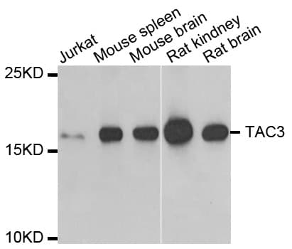 PathPlus™ Polyclonal Rabbit anti-Human TAC3 / Tachykinin Antibody (IHC, IF, WB)