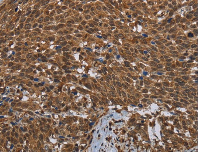 GCK / Glucokinase Antibody