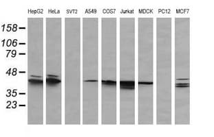 Monoclonal Mouse anti-Human MAPK3 / ERK1 Antibody (clone OTI4D7, IHC, IF, WB)