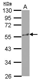 Polyclonal Rabbit anti-Human KATNA1 Antibody (WB)