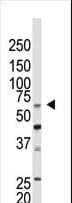Polyclonal Rabbit anti-Human CBX4 Antibody (aa80-110, IHC, WB)