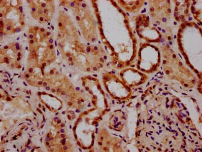 ACRC Antibody