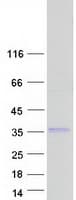 Human LAPTM4B Protein (Recombinant Myc-DDK (Flag))