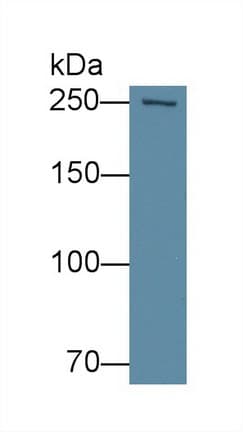 FASN / Fatty Acid Synthase Antibody (aa2263-2512)