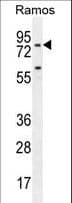 Polyclonal Rabbit anti-Human PDE4B Antibody (aa189-217, WB)