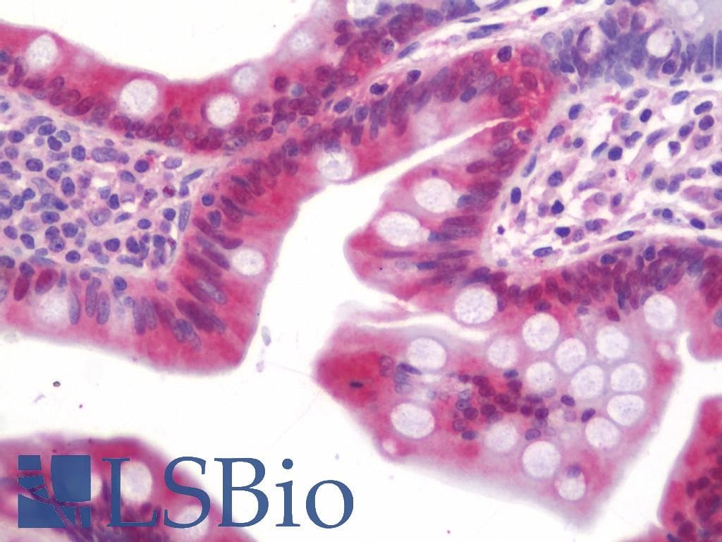 IHC-plus™ Polyclonal Rabbit anti-Human GSTA1 Antibody (IHC, WB)