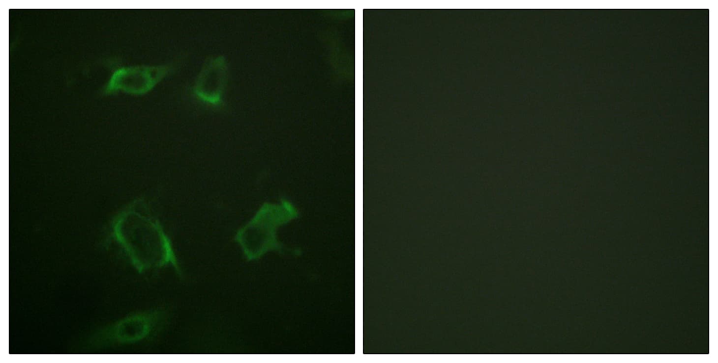 Polyclonal Rabbit anti-Human PLD1 / Phospholipase D1 Antibody (phospho-Ser561, IHC, IF)