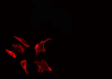 F2 / Prothrombin / Thrombin Antibody